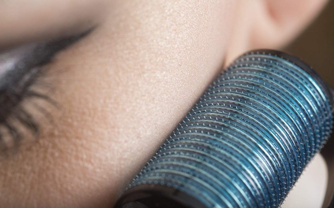 microneedling che cos'è